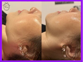 ヴィオール 名古屋栄店(VIOR)/パッと明るいくっきりフェイス♪