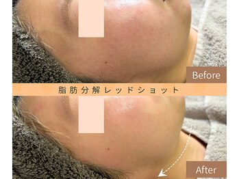 ルームエイトエイティスリー 新宿(R883)/レッドショットで引き締め