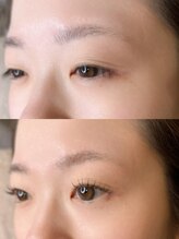 ニード 覚王山(NEED)/カウンセリングに力を入れてます