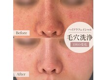 ルルアス(LuLuAS)の雰囲気（【肌ケア】毛穴洗浄+イオン導入も人気♪直後からツヤ感が好き）