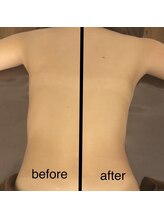 ミント(M’int)/お背中効果写真