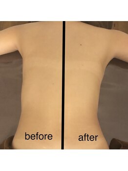 ミント(M’int)/お背中効果写真