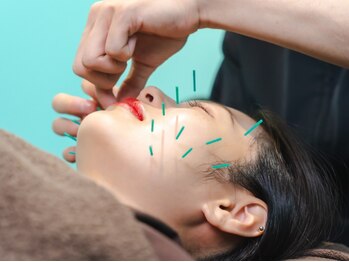 ビアンカ 鍼灸サロン川崎院(Bianca)の写真/【10万件を超える施術経験から高い効果を実感】鍼灸でお悩みの根本から改善！[川崎/鍼灸/美容鍼]