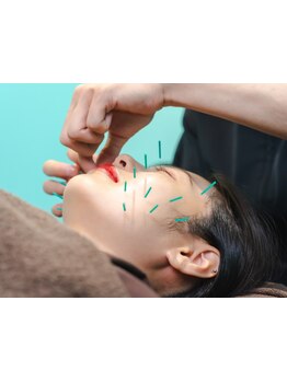 鍼灸施術を受けたい