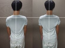 心鍼灸マッサージ整骨院/姿勢、骨盤矯正