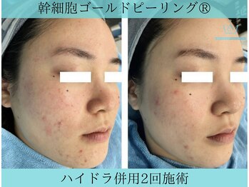 リメイククリニカルビューティー(Remake clinical beauty)/ぷつぷつも