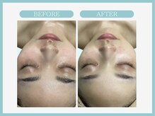 アコガレコガオ 仙台店/