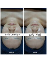 ベルクラージュ(Belle Courage)/20代　小顔