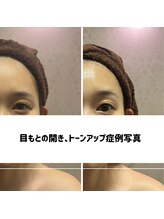 リジェ(Rege)/30代女性の方　施術