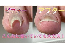 巻き爪本舗 津田沼店