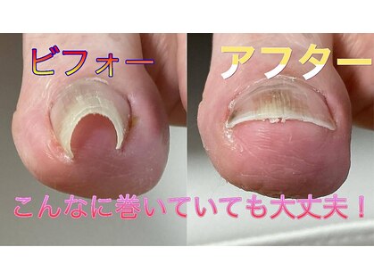 巻き爪本舗 津田沼店の写真