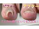 巻き爪本舗 津田沼店の写真