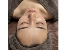 クレセント(CRESCENT)の雰囲気（ムダ毛をなくしたいそんなお悩みに【美肌脱毛】でつるつる素肌に）