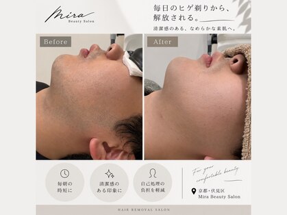ミラ(Mira)の写真