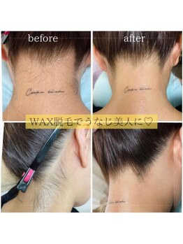 ミーミドットアイ(Mi-mi.i)/うなじ美人☆