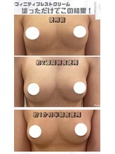 アネラ(ANERA) 心斎橋/バストクリームだけの購入可能♪