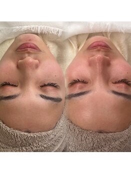 ポレ(pole)/洗顔で角質を1～2層除去