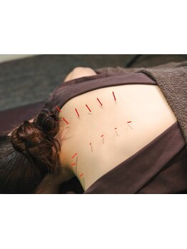 首・肩のつらさを改善したい