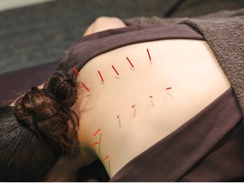 ビアンカ 鍼灸サロン川崎院(Bianca)の写真/つらい肩こりや首の痛みに◎重さが取れ慢性的なだるさから解放!疲労が溜まる原因に様々な角度からアプロ-チ