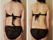 マナ(mana)/かけこみブライダルエステ