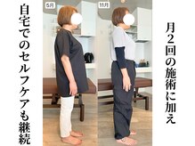 エボニー(Ebony)/姿勢の変化（6ヶ月）50代女性