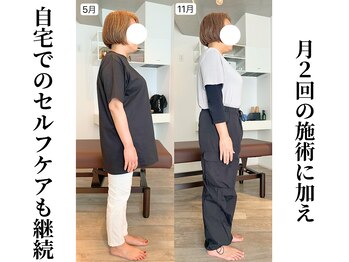 エボニー(Ebony)/姿勢の変化（6ヶ月）50代女性