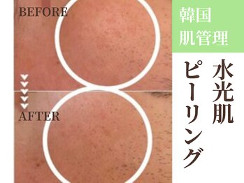 グラシーズ(Glasses)/毛穴やシミなどのトラブルに◎