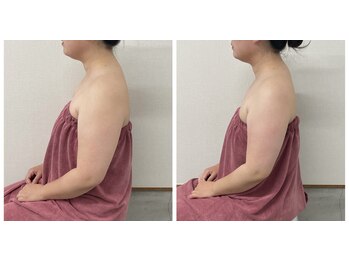 ブリランテ(Brillante)/