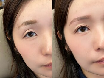 チルアンドアイ 千葉駅前店(Chill&Eye)/美眉スタイリング/BeforeAfter