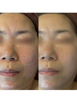 リディエイト(radiate.)/