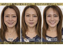 変化が出にくい40代以降の悩みに深く届く“土台矯正”が強み