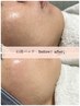 【人気No.1】よもぎ蒸し→痩身→石膏パック◎全身デトックスコース☆¥11000