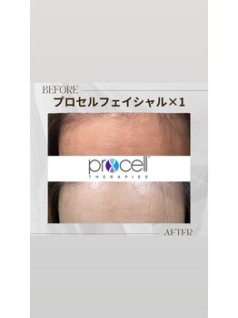クラロ ビューティー(CLARO BEAUTY)の写真/本気の肌改善を始めたい方へ