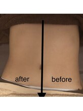 ミント(M’int)/お腹の効果写真