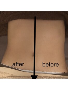 ミント(M’int)/お腹の効果写真