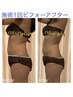 結果重視人気No.1痩身☆ハーブ×幹細胞培養液×インディバ【BODY】９０分