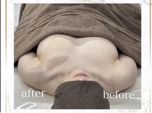 シャルマン(Charmant)/最新機器使用