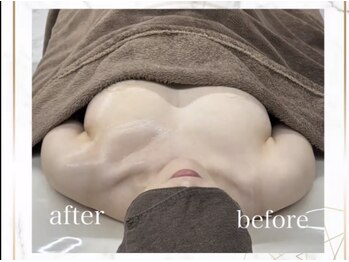 シャルマン(Charmant)/最新機器使用