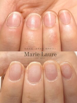 マリーロール 梅田店(Marie Laure)/深爪矯正/自爪育成/自爪風