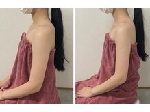 ブリランテ(Brillante)/体験beforeafter