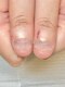 グラシュータン(gracieux temps)の写真/短期間で変化を実感◎爪の悩みは人それぞれ…自爪の健康を第一に考えた丁寧な施術&ケアをご提供★