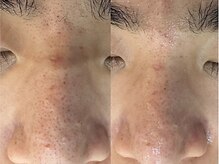 ケアナ 梅田店(CareNa)/メンズの清潔感ここにあり