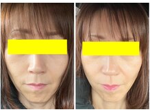 ビープラス 札幌整体院の雰囲気（「たぁたん様」の写真を頂きました！「口角の上りが良くなった」）