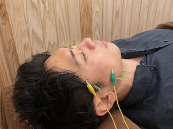 ととのえ処 良久庵/施術風景 メンズ美容鍼