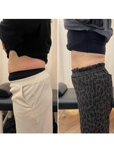 ナオ接骨院(NAO接骨院)/Before／After