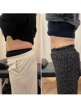 ナオ接骨院(NAO接骨院)/Before/After