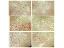 サロン ド ボーテ プルーラ(Salon de beaute PLURA)の雰囲気（黒ずみ、ひらき、つまり、あなたに最適なケアを！）