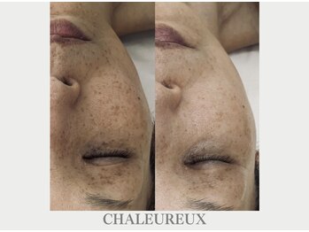 サロン ド ボーテ シャルル(Chaleureux)/