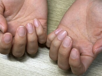 ハンド