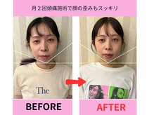 頭スッキリ整体サロン 伏見店の雰囲気（【小顔矯正】頭痛による顔の歪みまで一緒に解消致します。）